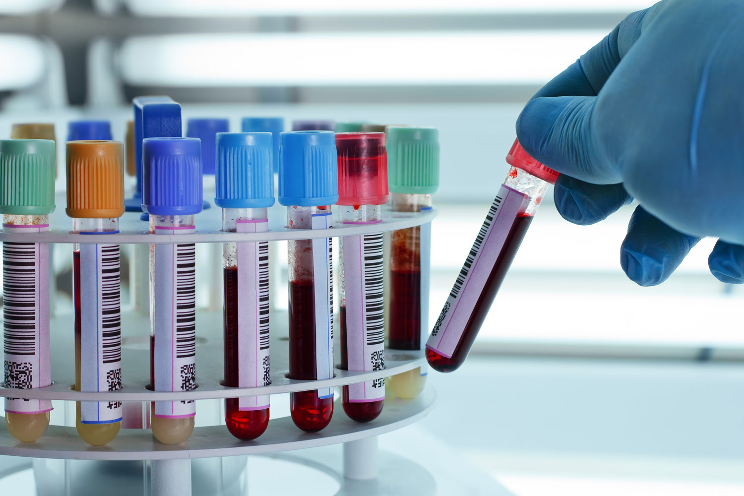 Lab Testing in Arizona – Accurate Results with Copper Valley Medical