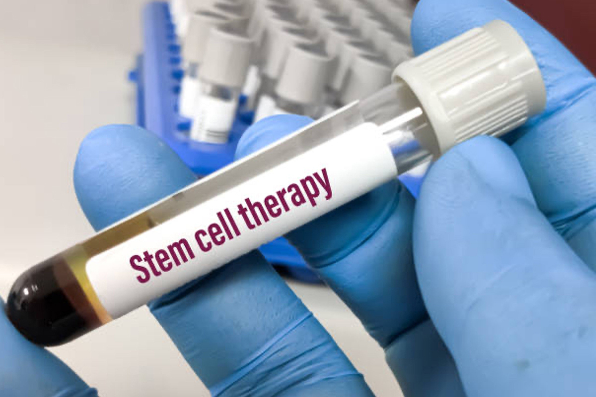 Stem Cell Therapy