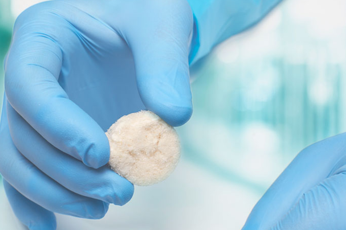 Tissue Allograft Therapy